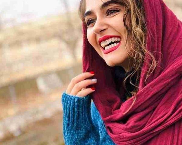 عکس ماه پیشونی در واقعیت