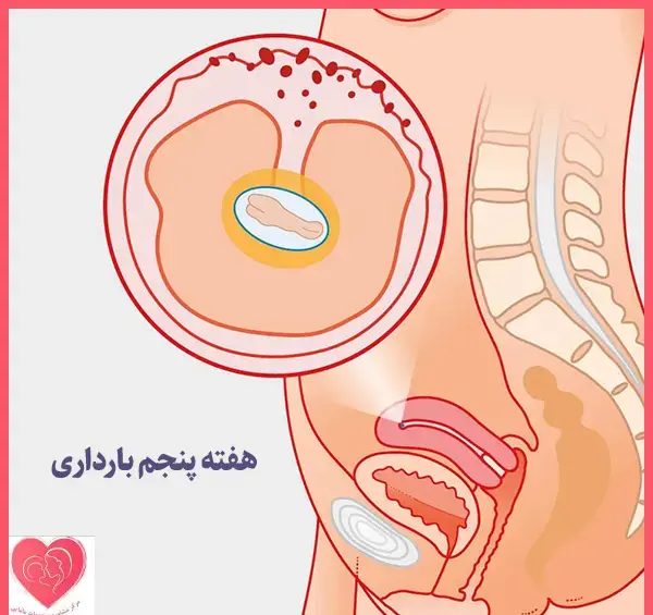 عکس لکه بینی هفته پنجم بارداری