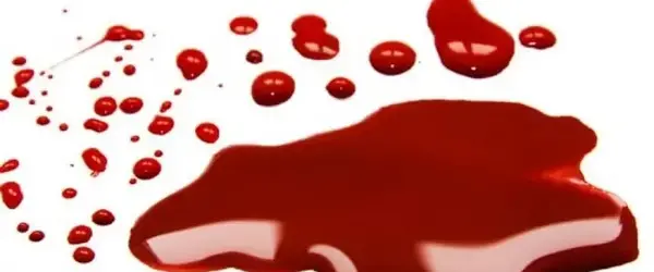 عکس رنگ لکه بینی در بارداری