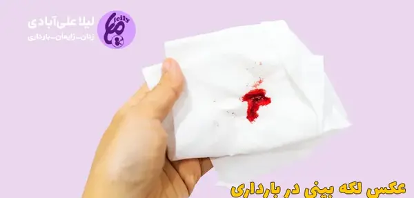 عکس رنگ لکه بینی در بارداری
