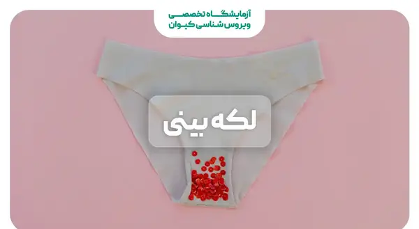 عکس لکه بینی حاملگی