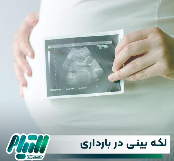 گزینی عکس لکه بینی در بارداری