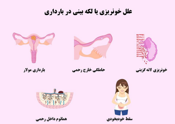 گزینی عکس لکه بینی در بارداری