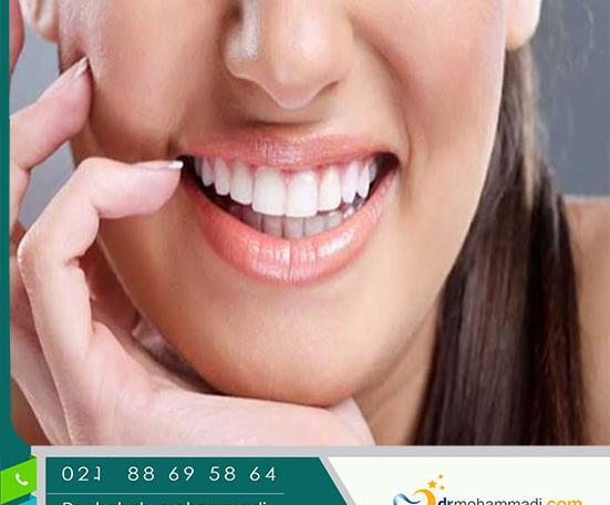 عکس لبخند هالیوودی