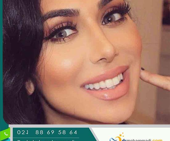 عکس لبخند هالیوودی