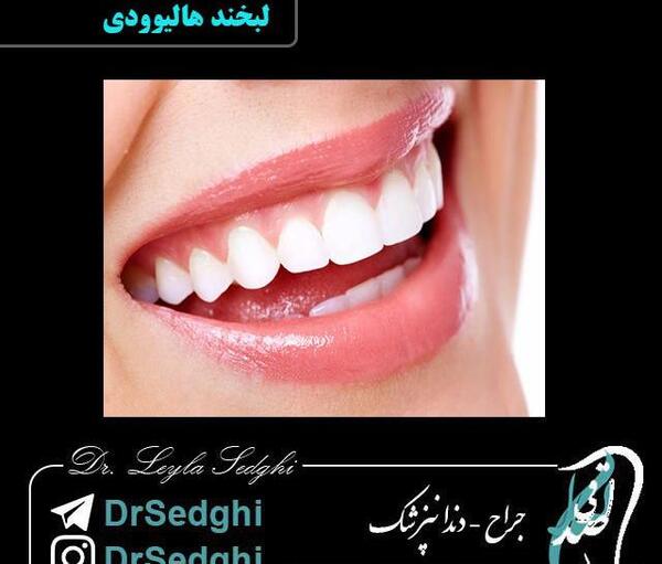 عکس لبخند هالیوودی