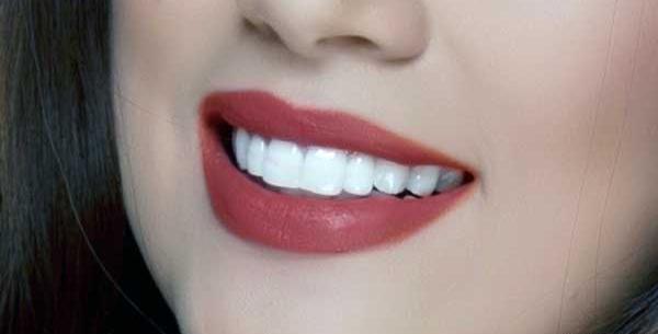 عکس لبخند هالیوودی