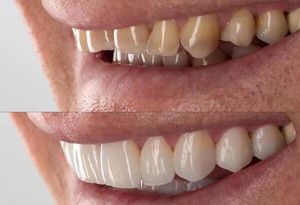 عکس های لبخند