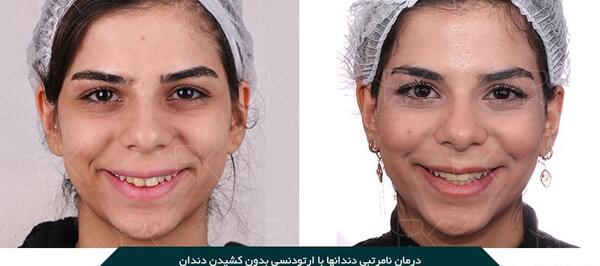عکس های لبخند زیبا