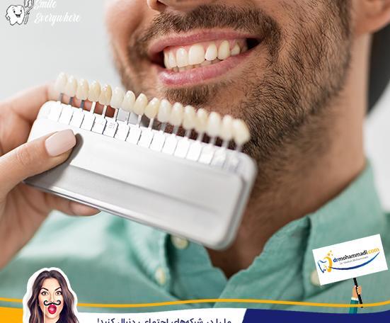 عکس کامپوزیت دندان طرح لبخند