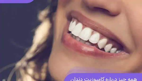 عکس کامپوزیت دندان طرح لبخند