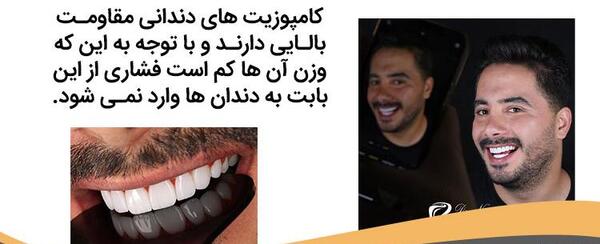عکس کامپوزیت دندان طرح لبخند