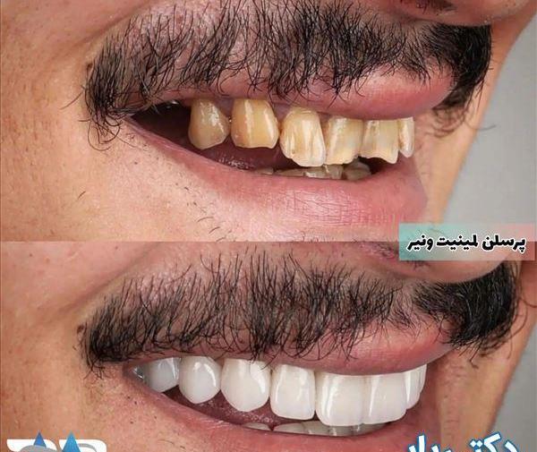 عکس دندان لبخند اسلامشهر