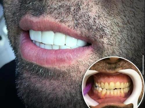 عکس دندان لبخند اسلامشهر