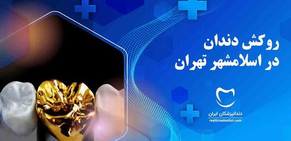 عکس دندان لبخند اسلامشهر