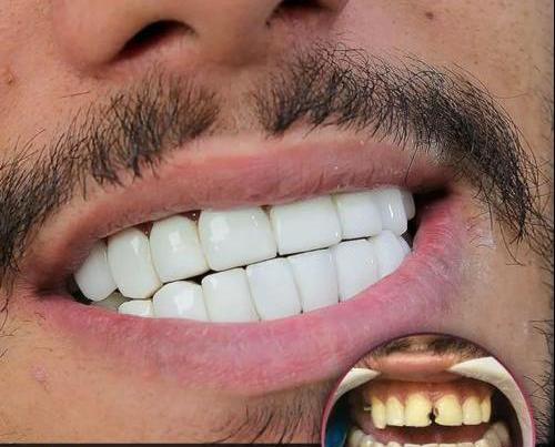عکس دندان لبخند اسلامشهر