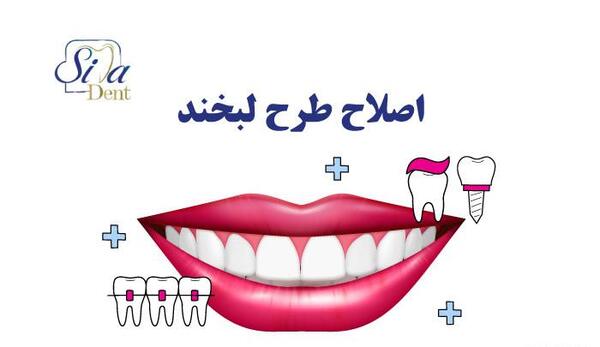 عکس دندان لبخند اسلامشهر