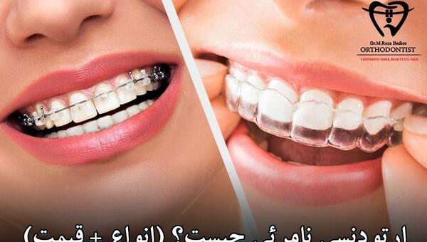عکس دندان لبخند اسلامشهر