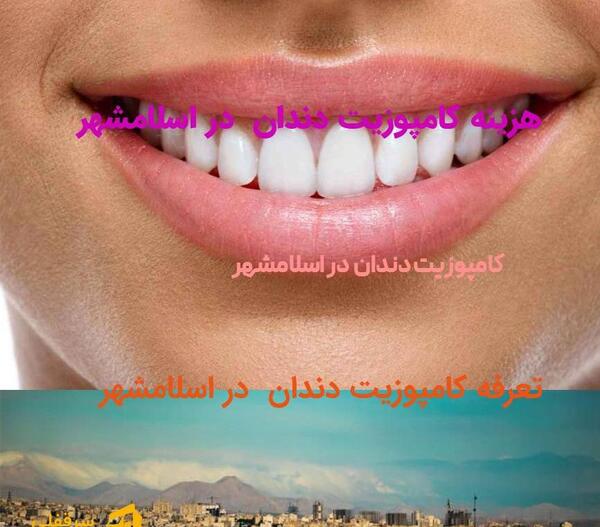 عکس دندان لبخند اسلامشهر