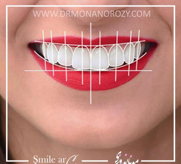 عکس لبخند برای دندانپزشکی