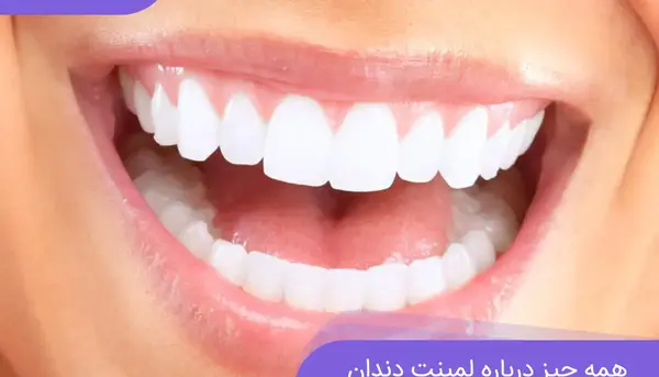 عکس لبخند برای دندانپزشکی