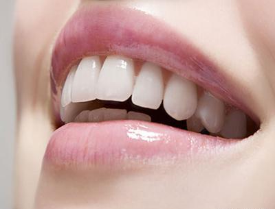 عکس لبخند برای دندانپزشکی