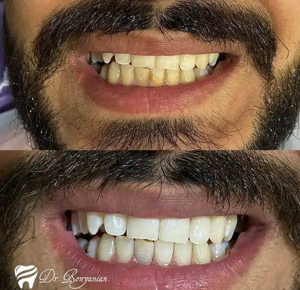 عکس لبخند برای دندانپزشکی