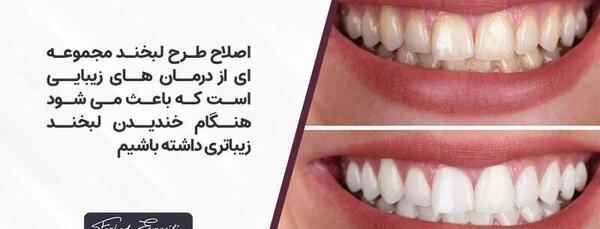 عکس لبخند برای دندانپزشکی