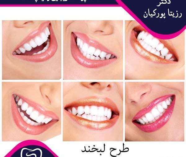 عکس لبخند برای دندانپزشکی