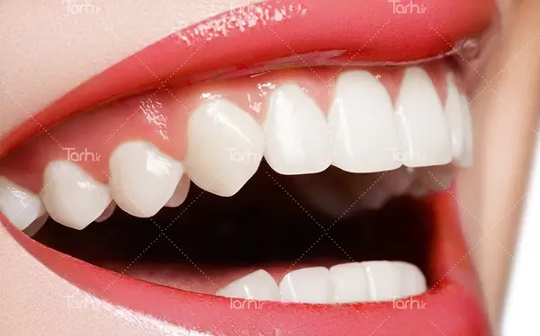 عکس لبخند برای دندانپزشکی