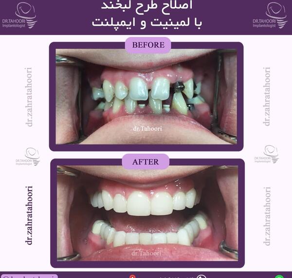 عکس لبخند و دندان