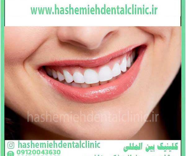 عکس لبخند و دندان