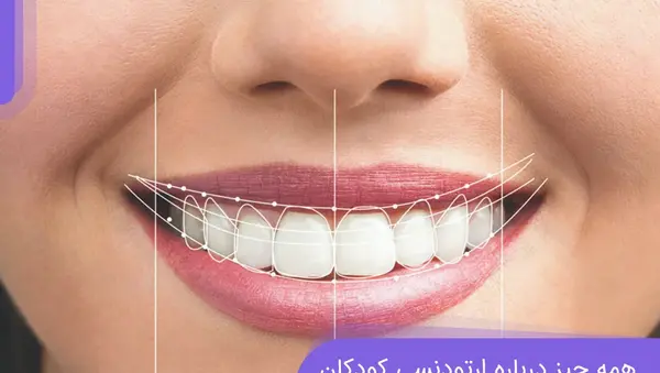 چگونه در عکس لبخند بزنیم