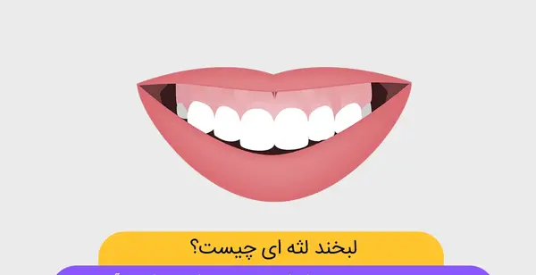 چگونه در عکس لبخند بزنیم