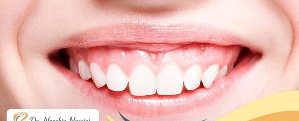 چطوری در عکس لبخند بزنیم