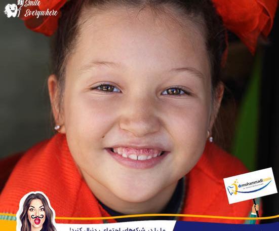 عکس لبخند بچه بی دندون