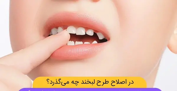 عکس لبخند بچه بی دندون