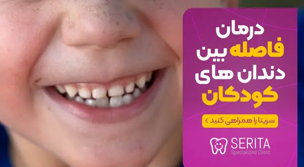 عکس لبخند بچه بی دندون