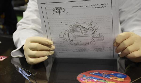 عکس تشریح چشم گاو