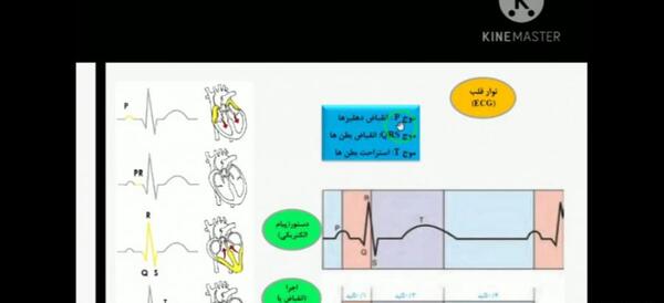 عکس نوار قلب کتاب زیست دهم