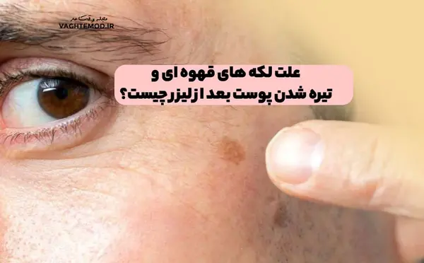 عکس لکه های قهوه ای زیر بغل