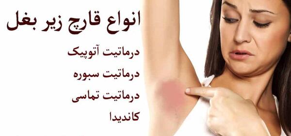عکس لکه های قهوه ای زیر بغل