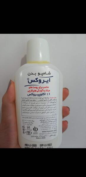 عکس لکه های قهوه ای زیر بغل نی نی سایت
