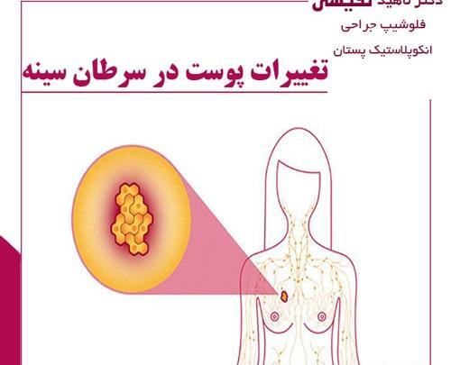 عکس لکه های قهوه ای زیر بغل نی نی سایت