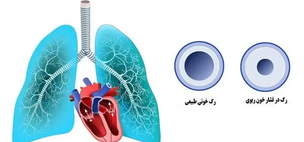 عکس متحرک قلب انسان