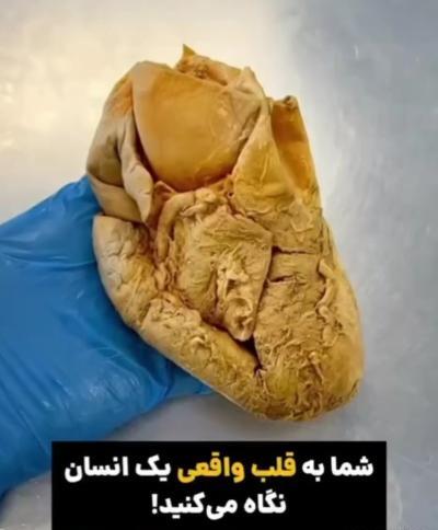قلب انسان عکس واقعی