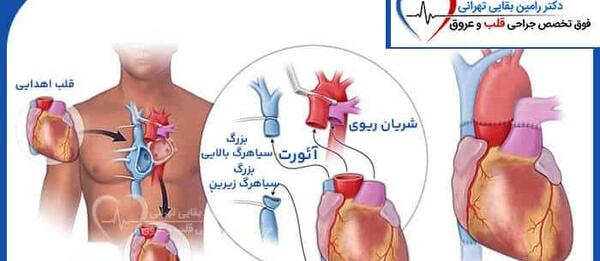 عکس از داخل قلب انسان