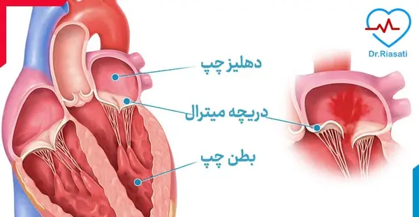 عکس دریچه های قلب انسان