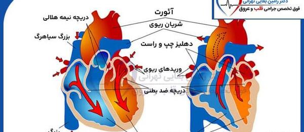 عکس دریچه های قلب انسان