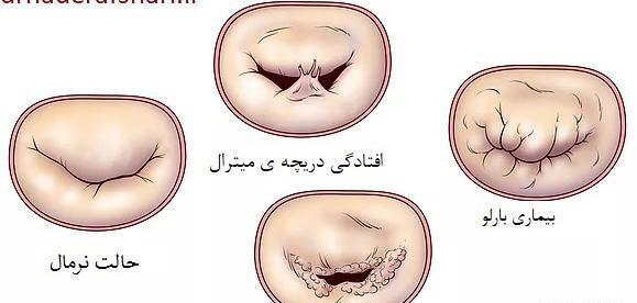 عکس قلب درد زنان